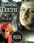 Missing Teeth - Svart Tandfärg